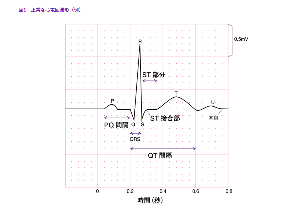 薬剤師が知っておきたい「心電図」の基本
